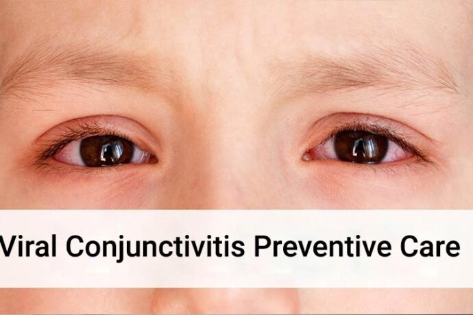 Viral-Conjunctivitis-Preventive-Care