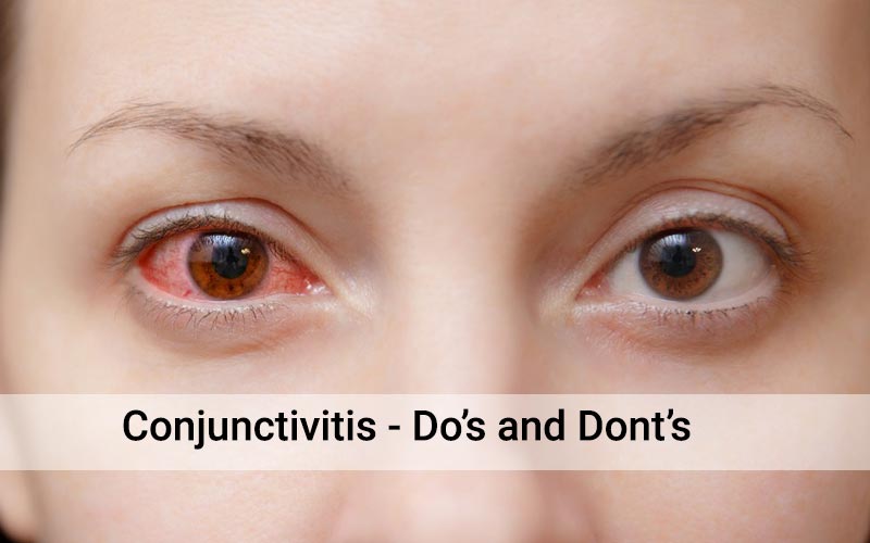 Conjunctivitis
