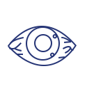 Glaucoma
