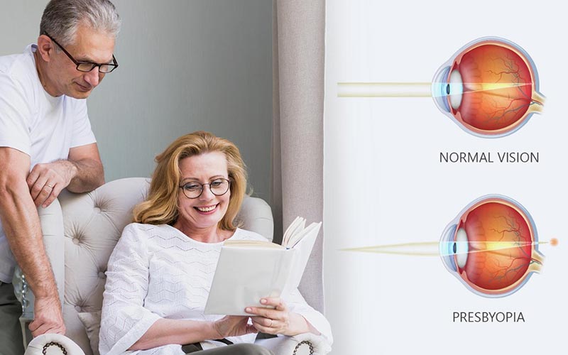 Understanding-and-living-with-Presbyopia