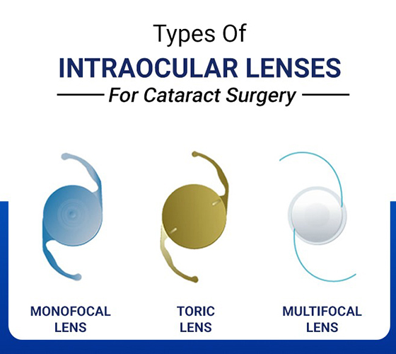cataract surgery lenses