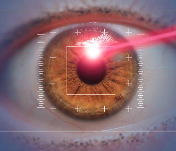 lasik eye surgery in noida