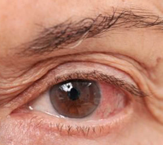 eye treatment in noida gaziabad