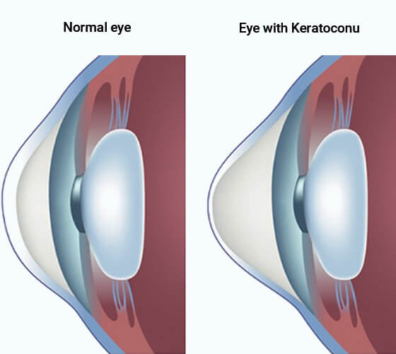 Specialized-Treatment--kerotonics