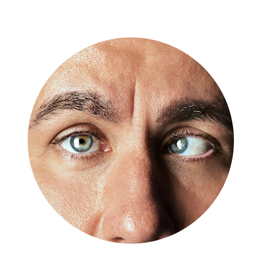 Crossed Eyes
