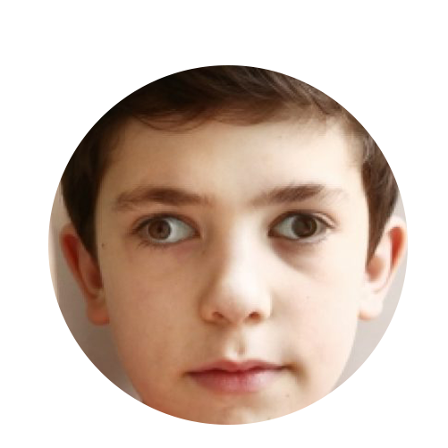 Uncoordinated Eye Movements
